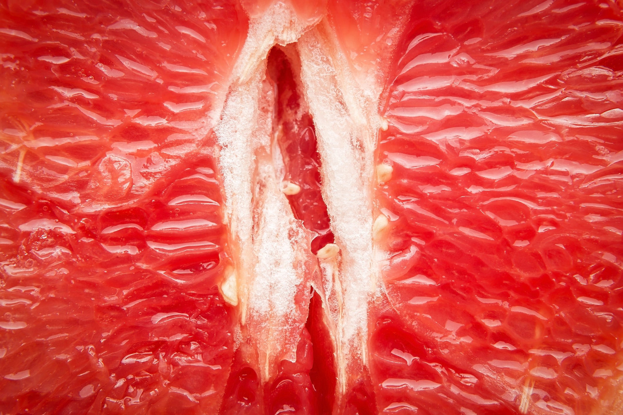 Smega: A Potenial Cause for Anaorgasm and Reduced Desire in Women